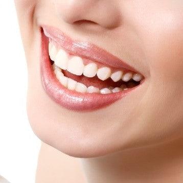 How Long Does Teeth Whitening Last?