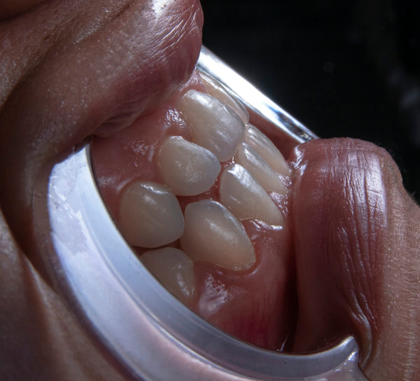 The Science Behind Bliss Oral Care's Teeth Whitening Magic Explained