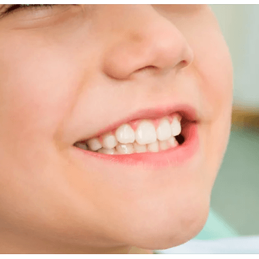 The Ultimate Guide to Kids' Teeth Whitening